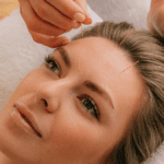 Acupuncture du visage | Treatwell