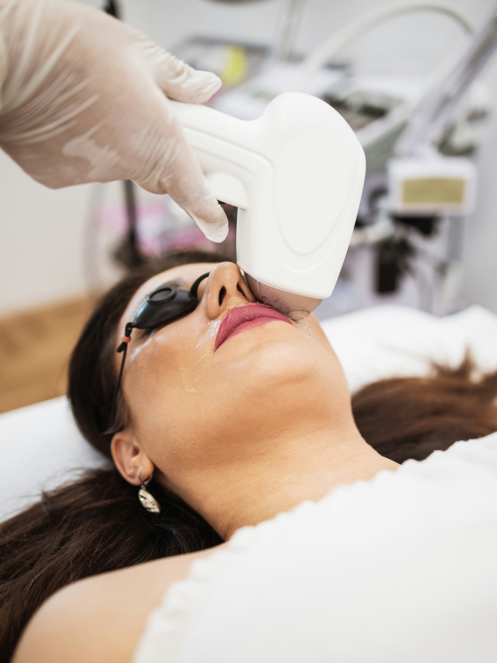 Femme recevant un soin IPL sur la lèvre supérieure en institut