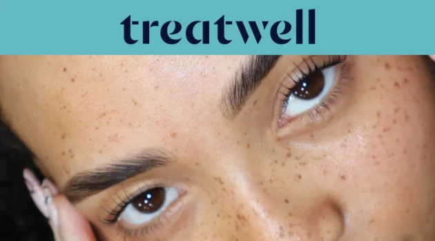 Banner Treatwell turchese con primo piano di ciglia naturalmente sollevate dopo una laminazione ciglia coreana, su pelle con lentiggini