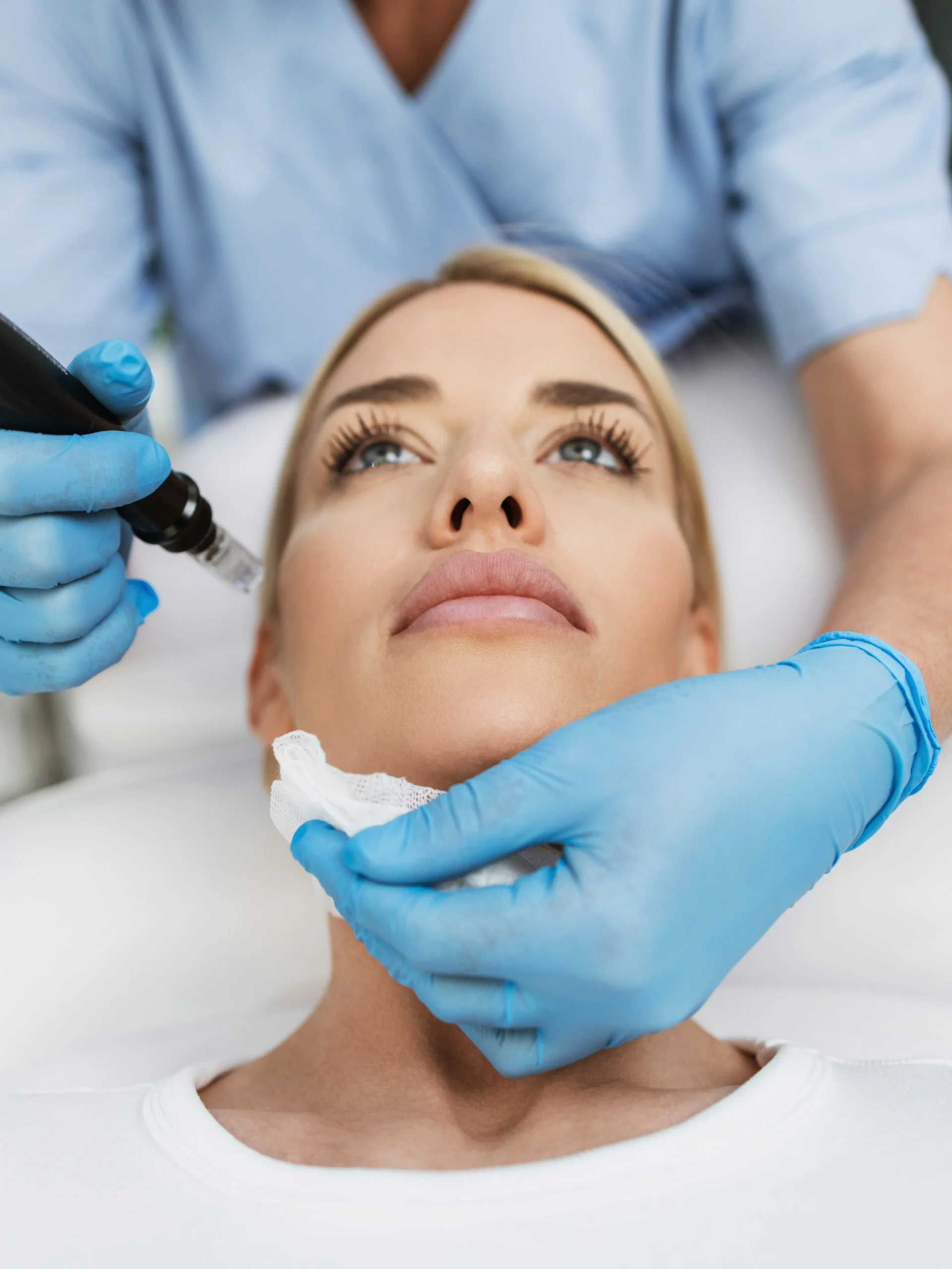 Nahaufnahme einer Frau, die entspannt auf einer Behandlungsliege liegt und in einer Klinik Microneedling erhält