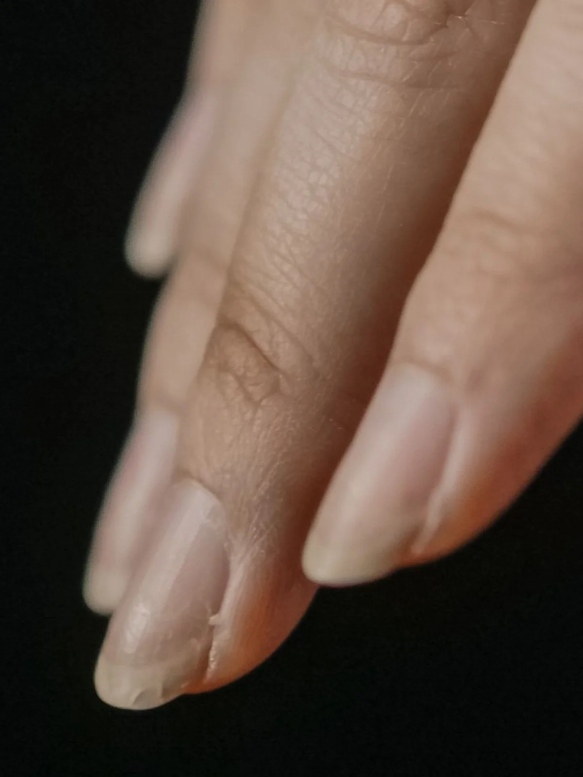 Nahaufnahme einiger Fingernägel mit Splissen an der freien Kante